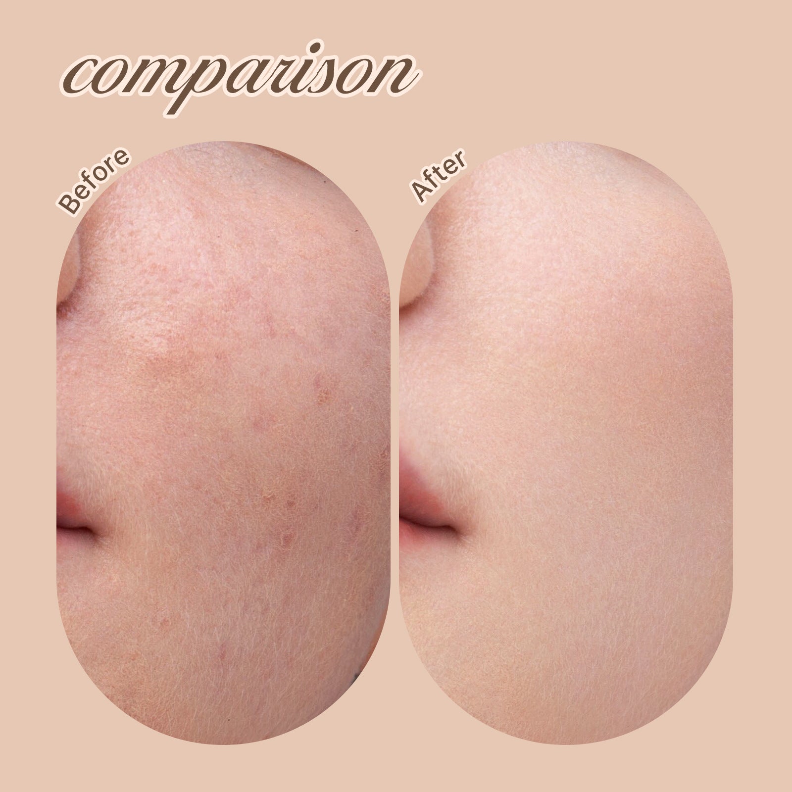 Liquid Concealer Dark Small Feeding Bottle Concealer LK57C